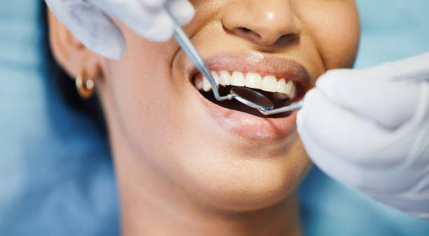Best Walk-In Emergency Dentist in Redwood City, CA
