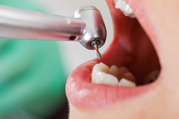 Best Emergency Dental Care for Trauma or Injury in Redwood City, CA